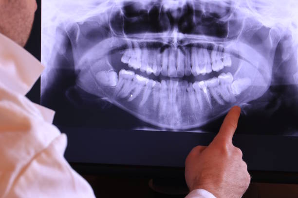 Best Knocked-Out Tooth Emergency  in Thatcher, AZ