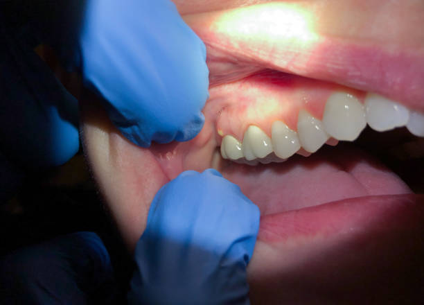 Tooth Infection Emergency Dentist in AZ